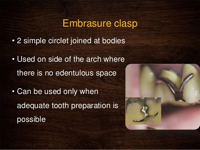 side of the anal clasp Side of the anal clasp